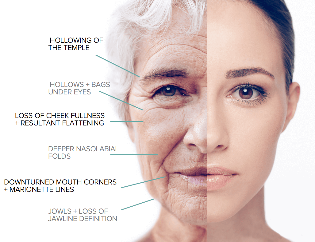 old versus young old versus young